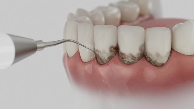 Reliable Root Canal Treatment contractor in Edmonson County County, KY by Dentist Open Now